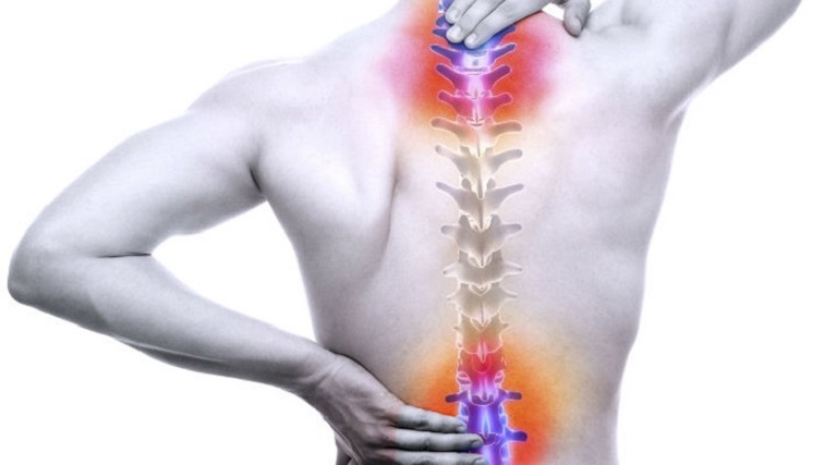 Nếu thường xuyên bị đau ở cổ và thắt lưng liên tục rất có thể là dấu hiệu của bệnh