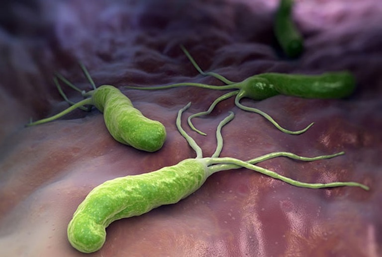 Vi khuẩn HP là gì? Vi khuẩn này có tên đầy đủ là Helicobacter Pylori