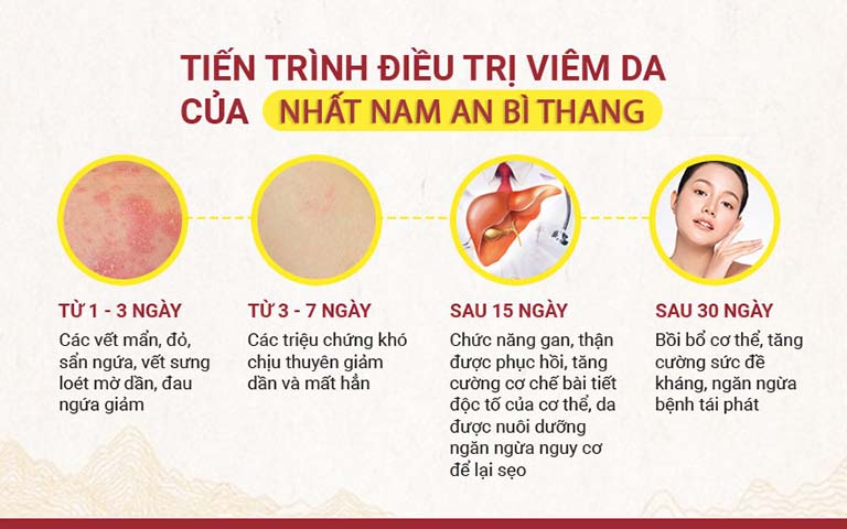 Bài thuốc Nhất Nam An Bì Thang được bác sĩ Nhuần dành lời khen vì phác đồ linh hoạt
